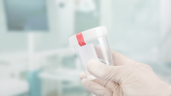 donar esperma